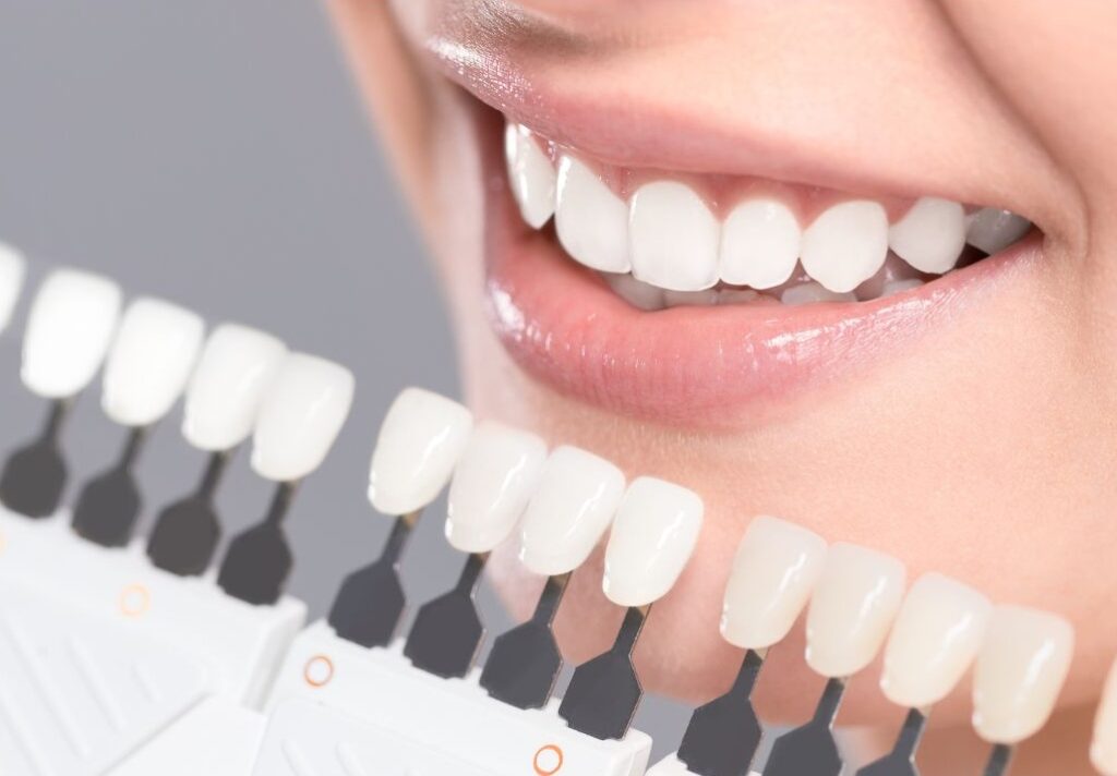 Enhancing your Smile with Teeth Whitening